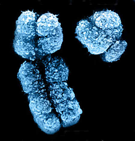 A human X and Y chromosome